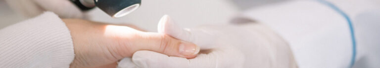 Closeup of dermatologist examining mole on hand of female patien
